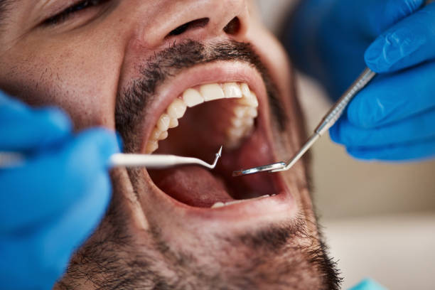 Best Emergency Dental Care for Broken or Chipped Teeth in Clawson, MI